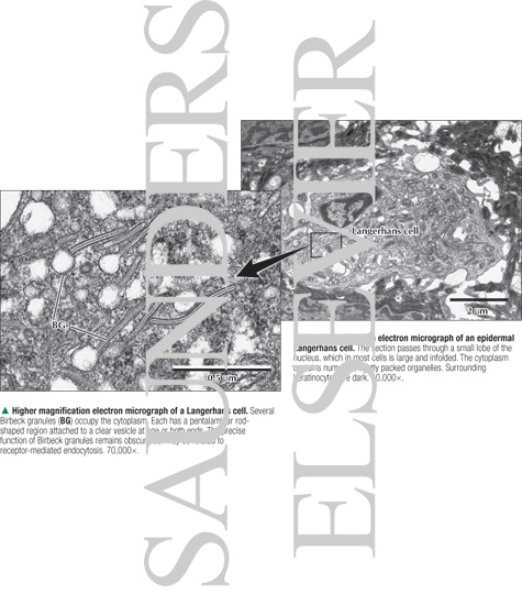 Higher Magnification Electron Micrograph of a Langerhans Cell With Low-magnification Electron Micrograph of an Epidermal Langerhans Cell