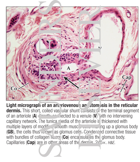 Watermarked preview of labeled image: Light Micrograph of an Arteriovenous Anastomosis In the Reticular Dermi
