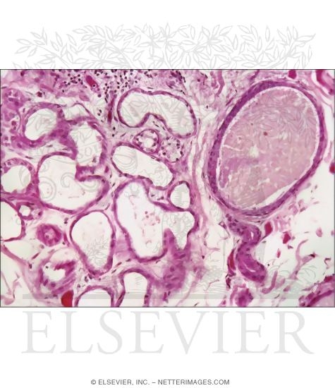 Light Micrograph of an Apocrine Sweat Gland In Axillary Skin