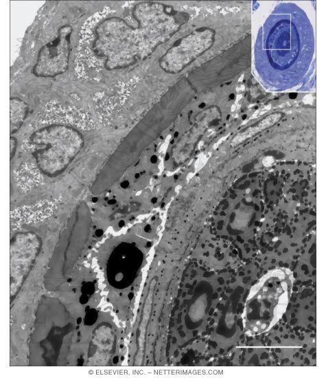 Watermarked preview of unlabeled image: Electron Micrograph of Part of a Hair and Its Follicle In Transverse Section