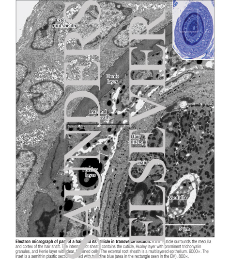 Watermarked preview of labeled image: Electron Micrograph of Part of a Hair and Its Follicle In Transverse Section
