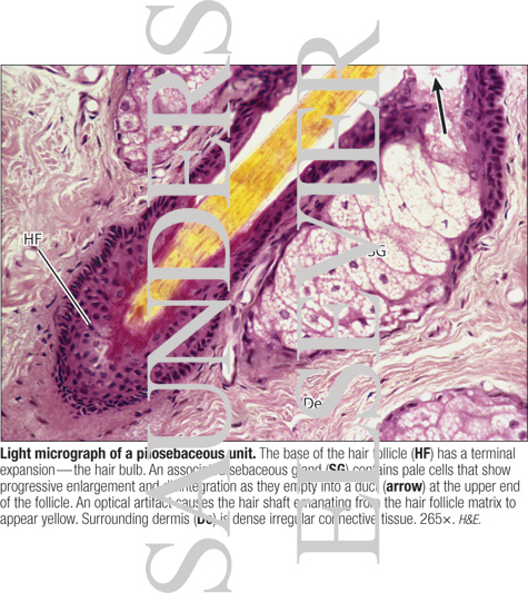 Watermarked preview of labeled image: Light Micrograph of a Pilosebaceous Unit