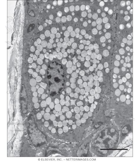 Electron Micrograph of Part of a Sebaceous Gland