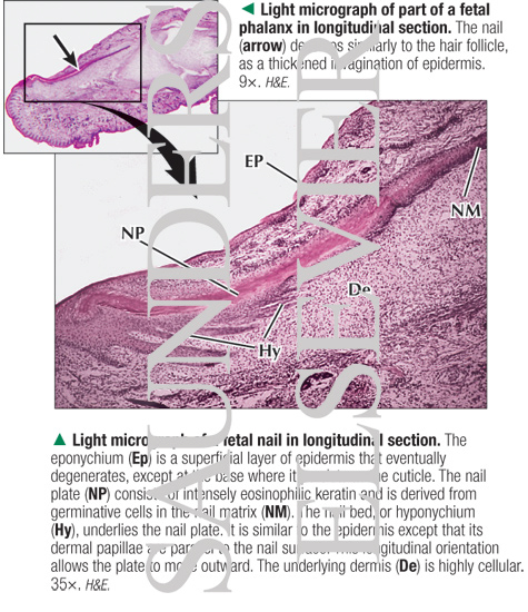 Light Micrograph of a Fetal Nail In Longitudinal Section With Light  Micrograph of Part of a
