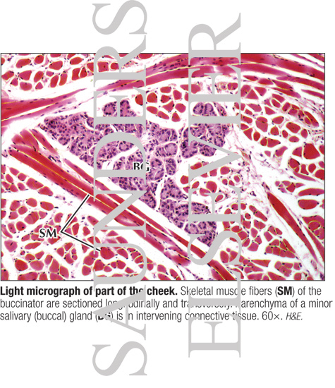 Watermarked preview of labeled image: Light Micrograph of Part of the Cheek