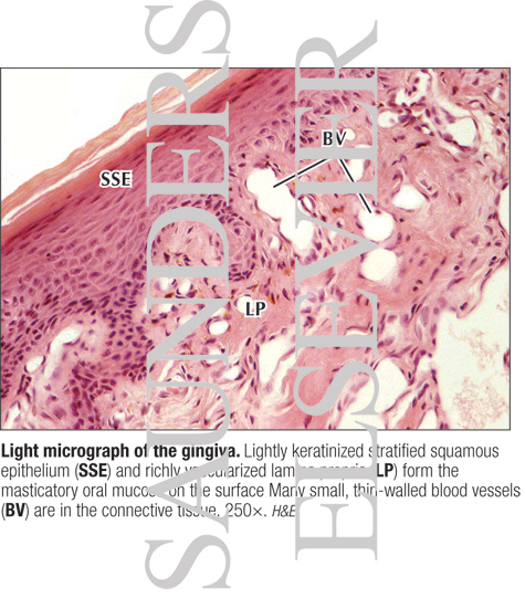 Watermarked preview of labeled image: Light Micrograph of the Gingiva