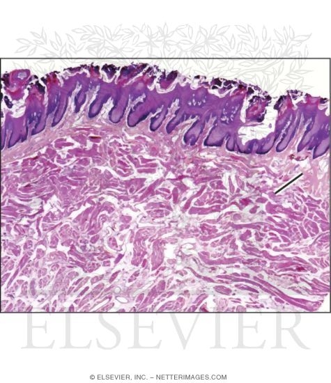 Watermarked preview of unlabeled image: Light Micrograph of the Dorsum of the Tongue at Low Magnification