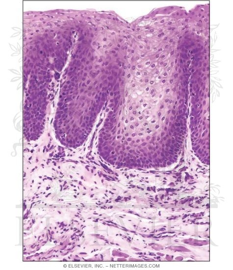 Watermarked preview of unlabeled image: Light Micrograph of the Undersurface of the Tongue