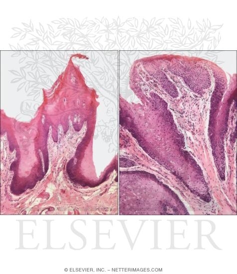 Watermarked preview of unlabeled image: Light Micrographs of Filiform (Left) and Fungiform (Right) Papillae