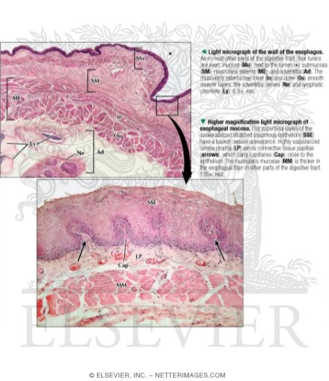 Light Micrograph of the Wall of the Esophagus With Higher Magnification Light Micrograph of 
esophageal Mucosa