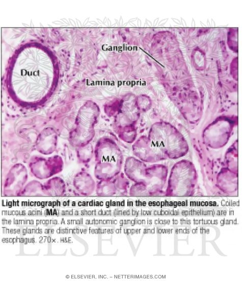 Watermarked preview of labeled image: Light Micrograph of a Cardiac Gland In the Esophageal Mucosa
