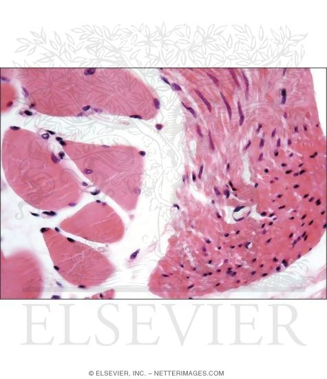 Watermarked preview of unlabeled image: Higher Magnification Light Micrograph of Two Types of Muscle Tissue In the Esophagus