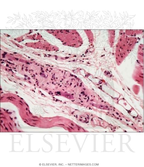 Watermarked preview of unlabeled image: Light Micrograph of a Myenteric Plexus In the Muscularis Externa of the Esophagus