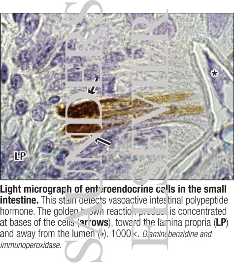 Watermarked preview of labeled image: Light Micrograph of Enteroendocrine Cells In the Small Intestine