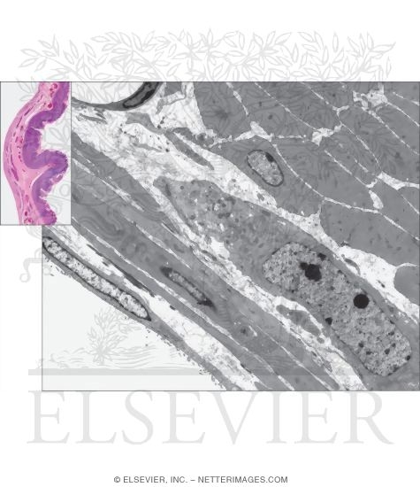 Watermarked preview of unlabeled image: Light Micrograph of the Stomach Wall With Electron Micrograph of the Outer Wall of the Stomach