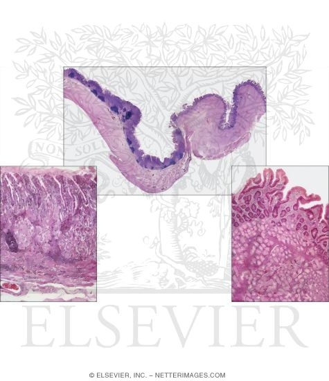 Light Micrographs of the Gastroduodenal Junction