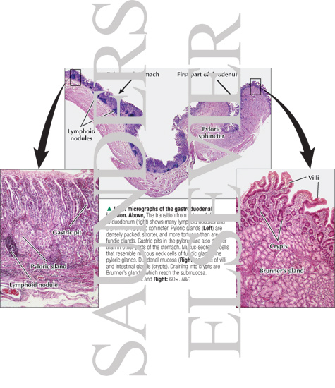 Watermarked preview of labeled image: Light Micrographs of the Gastroduodenal Junction