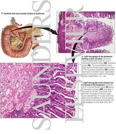 Watermarked preview of labeled image: Duodenal Bulb and Mucosal Surface of Duodenum With Light Micrograph of the Duodenum 
showing a Plica Circularis and Light Micrograph of the Mucosa and Submucosa of the Duodenum