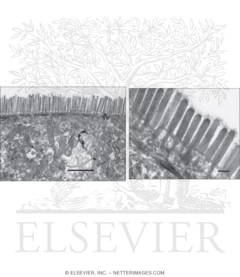 Watermarked preview of unlabeled image: Electron Micrographs of Enterocytes at Low (Left) and High (Right) Magnification