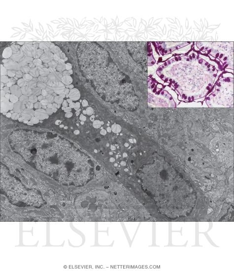 Electron Micrograph of Part of the Epithelium of the Small Intestine With Light Micrograph of a Villus In the Jejunum In Transverse Section (top Right)