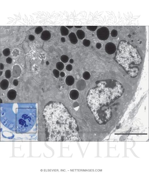 Electron Micrograph of Paneth Cells With Light Micrograph of the Base of an Intestinal Crypt Showing Paneth Cells (Left)