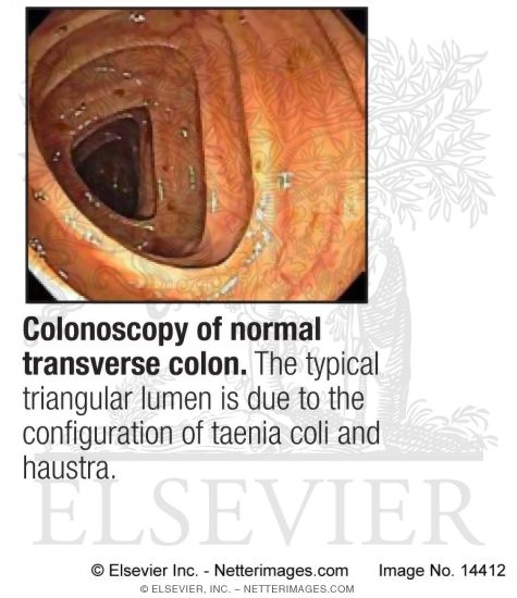 Colonoscopy of Normal Transverse Colon