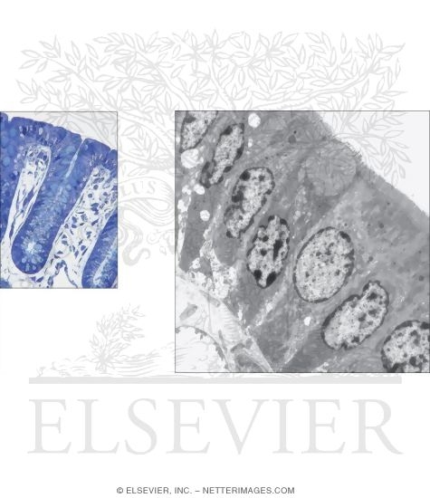 Watermarked preview of unlabeled image: Light Micrograph of the Colonic Mucosa With Electron Micrograph of the Colonic Mucosa