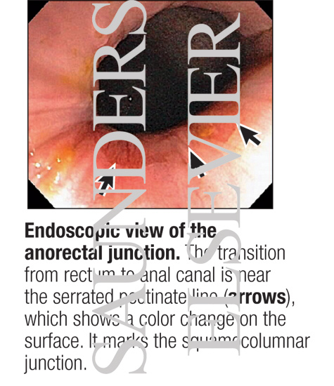 Endoscopic View of the Anorectal Junction
