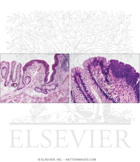 Light Micrographs of the Anorectal Junction at Low (Left) and High (Right) Magnifications