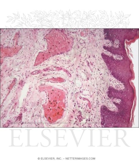 Watermarked preview of unlabeled image: Light Micrograph of the Mucosa of the Anal Canal
