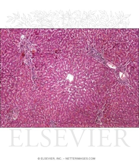 Light Micrograph of a Hepatic Lobule