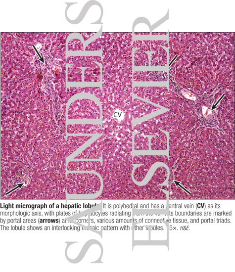 Watermarked preview of labeled image: Light Micrograph of a Hepatic Lobule