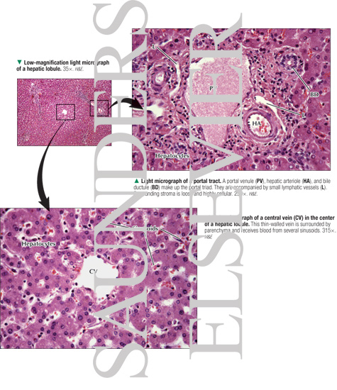 Watermarked preview of labeled image: Low-magnification Light Micrograph of a Hepatic Lobule With Light Micrograph of a Portal Tract and Light Micrograph of a Central Vein In the Center of a Hepatic Lobule