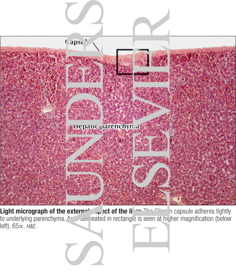 Watermarked preview of labeled image: Light Micrograph of the External Aspect of the Liver