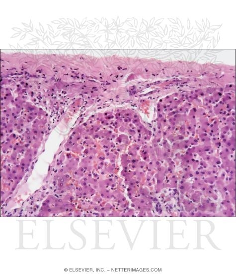 Light Micrograph of the Surface of the Liver