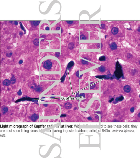 Watermarked preview of labeled image: Light Micrograph of Kupffer Cells In Rat Liver