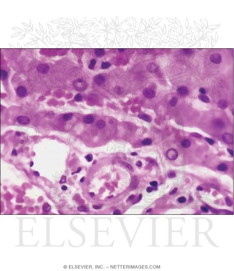 Light Micrograph of the Liver Showing Plates of Hepatocytes and the Space of Dissé
