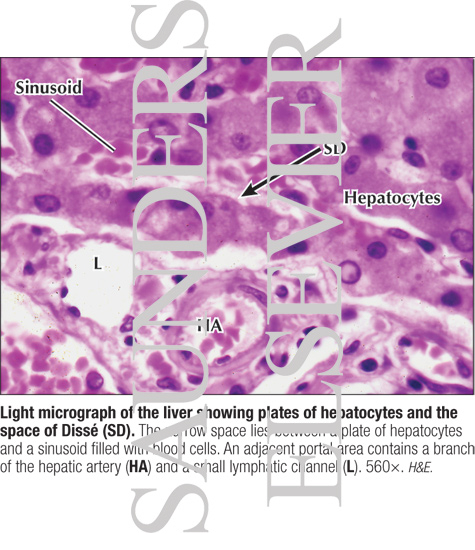 Light Micrograph of the Liver Showing Plates of Hepatocytes and the Space of Dissé