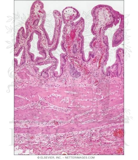 Light Micrograph of Part of a Nondistended Gallbladder