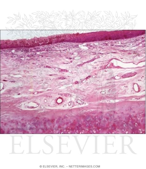 Light Micrograph of Part of the Epiglottis