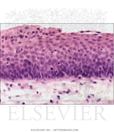 Details of the Epithelial Transition at the Laryngeal Surface of the Epiglottis at High Magnification