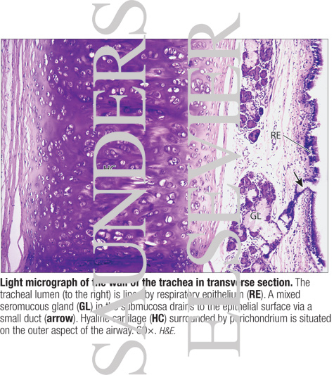 Light Micrograph of the Wall of the Trachea In Transverse Section