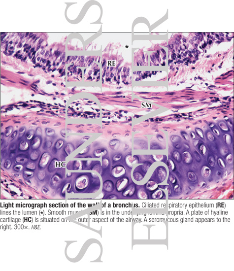 Light Micrograph Section of the Wall of a Bronchus