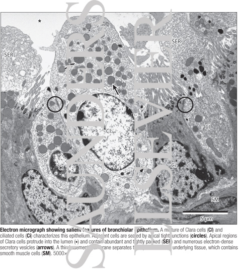Watermarked preview of labeled image: Electron Micrograph Showing Salient Features of Bronchiolar Epithelium