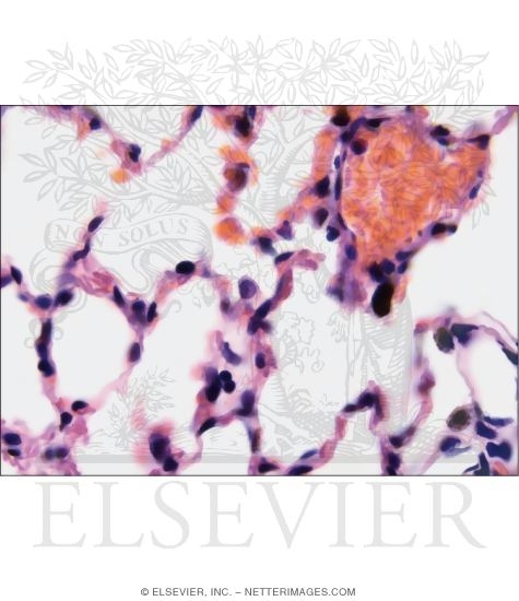 Light Micrograph of the Parenchyma of the Lung
