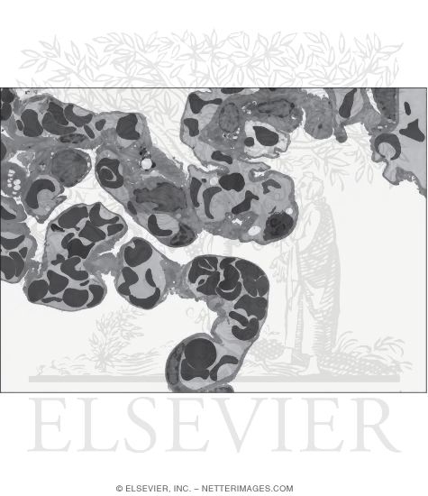 Electron Micrograph of the Alveoli of the Lung