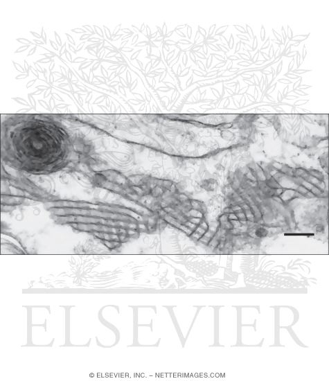 Watermarked preview of unlabeled image: Electron Micrograph of Surfactant at High Magnification