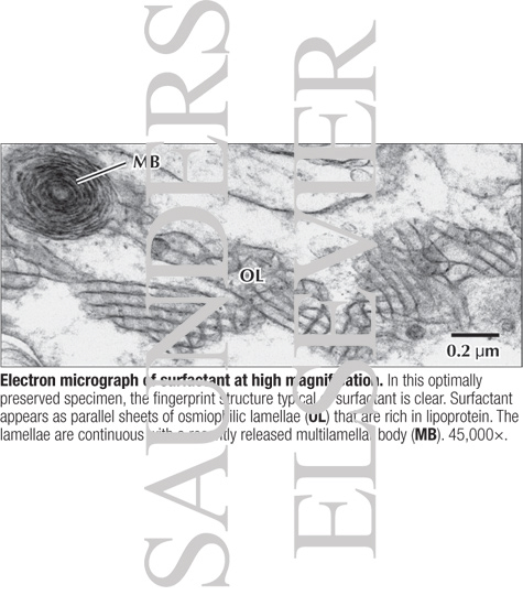 Watermarked preview of labeled image: Electron Micrograph of Surfactant at High Magnification
