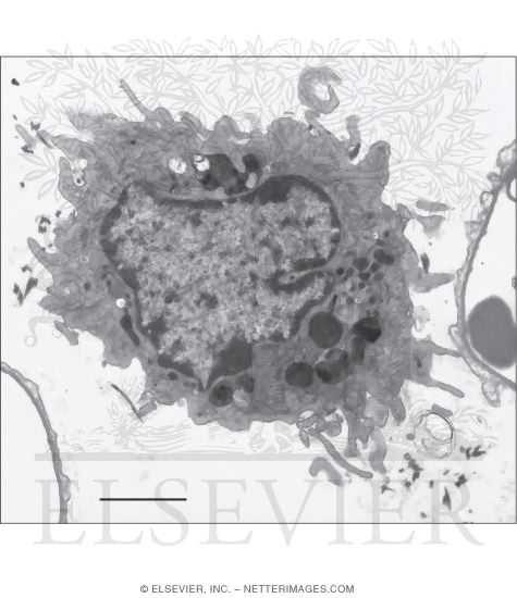 Electron Micrograph Showing Salient Features of an Alveolar Macrophage (dust Cell)