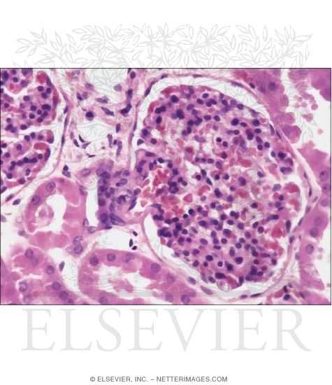 Light Micrograph of a Renal Corpuscle and Its Juxtaglomerular Complex